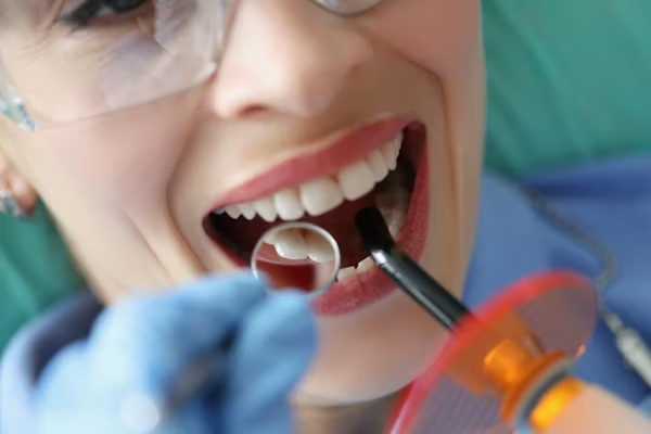 photo of a woman's teeth during a dental check-up