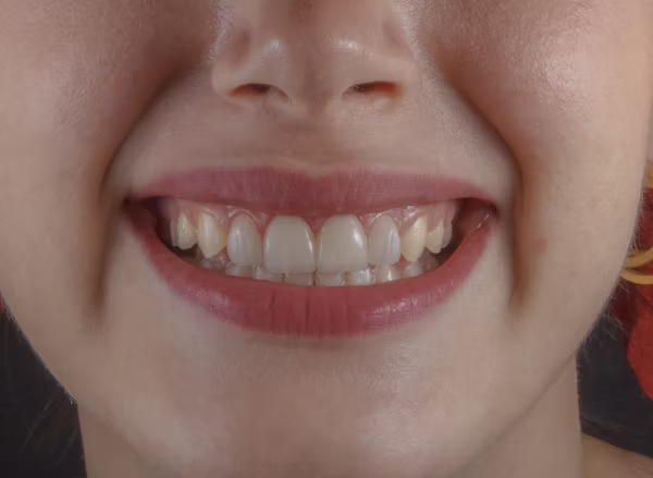 close up shot of a person's teeth
