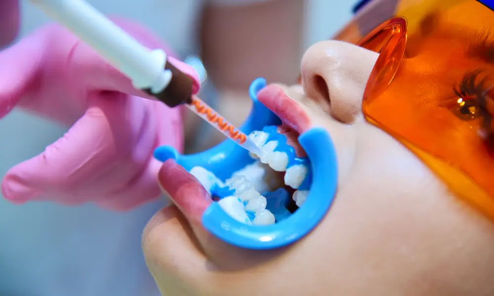 patient receiving teeth whitening treatment with gel and LED light Charlotte NC